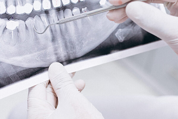 Oral Diagnoz ve Radyoloji