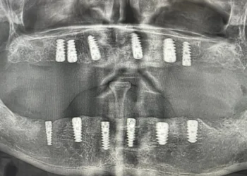 patient-three-rontgen