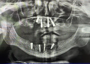 patient-two-rontgen